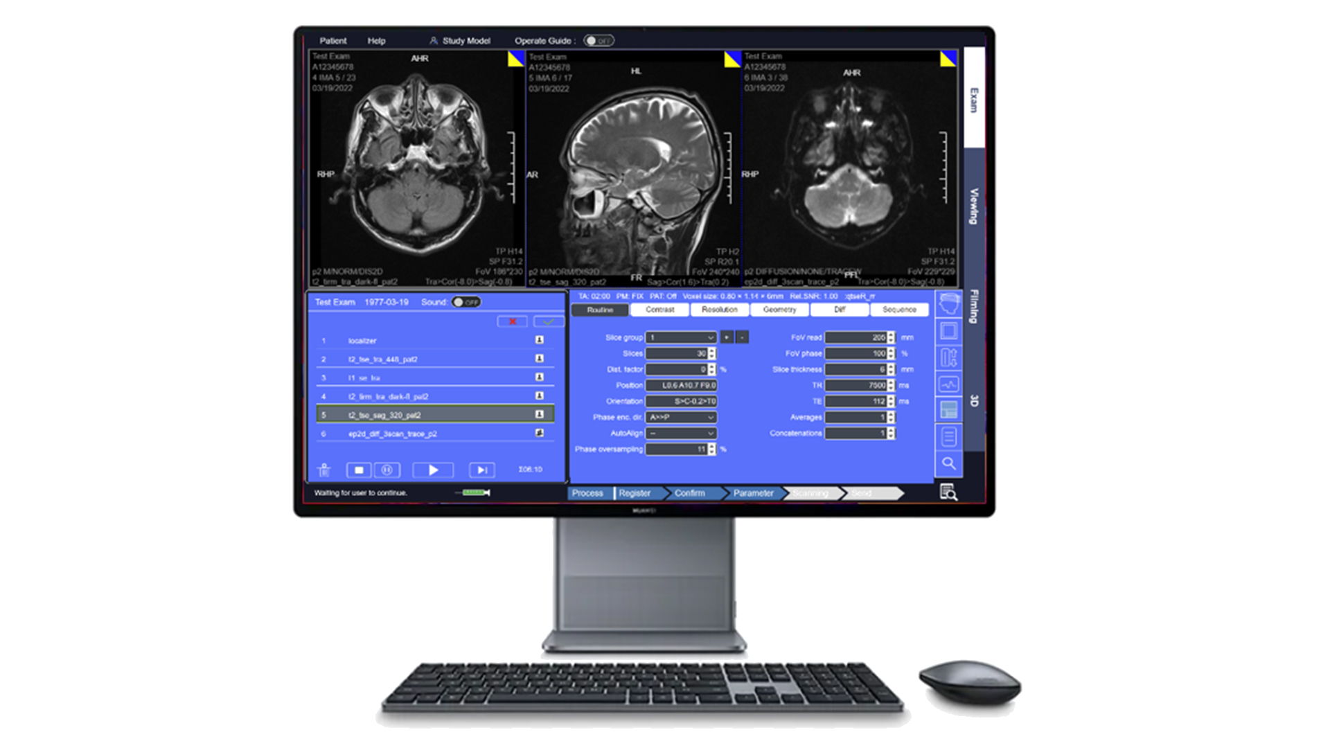 MRI Simulator Screenshot 3