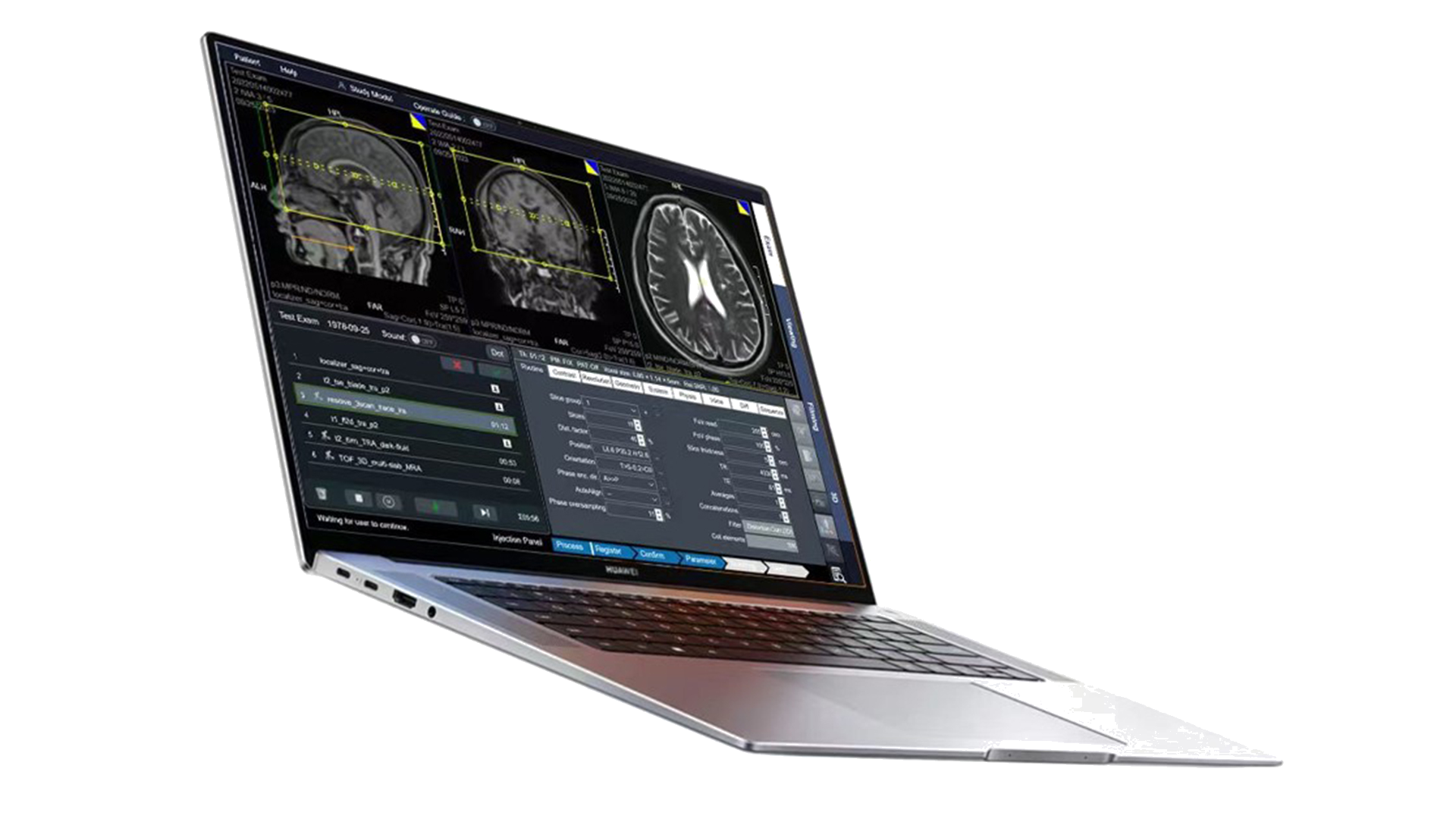 MRI Simulator Screenshot