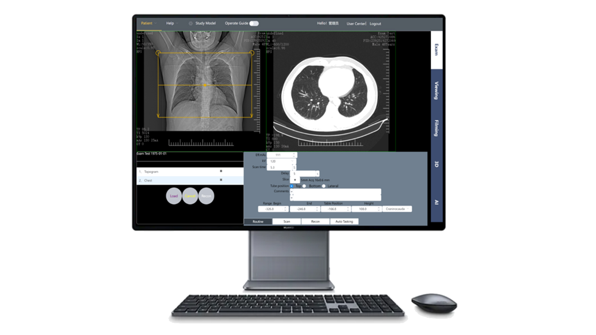 CT Simulator Screenshot 5