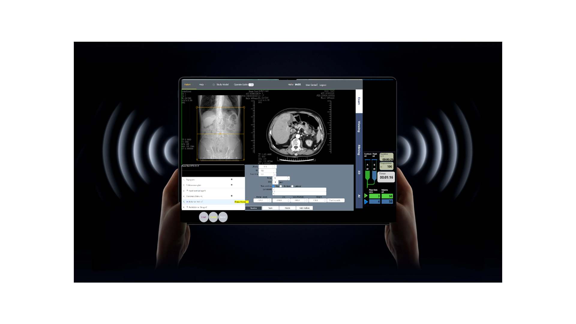 CT Simulator Screenshot 6