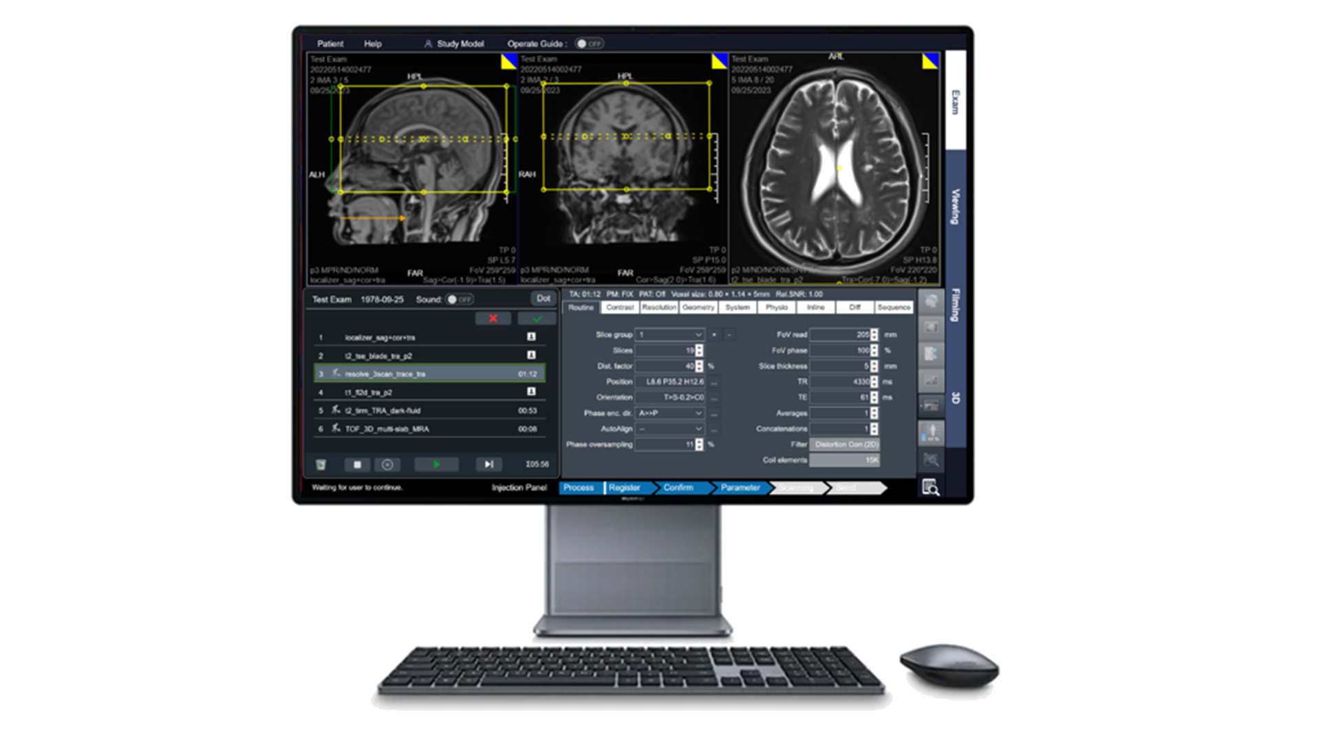 MRI Simulator Screenshot 2